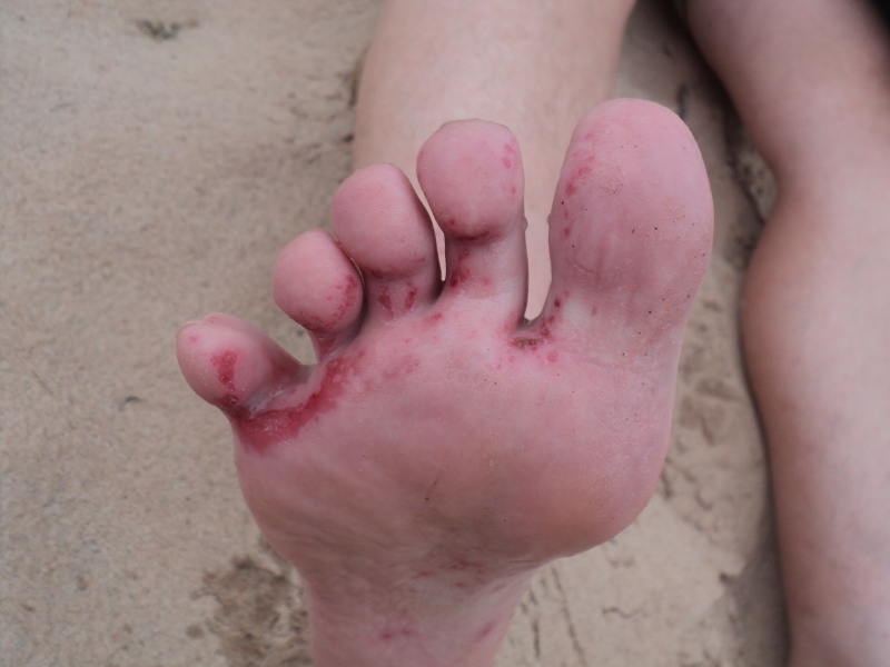 foot